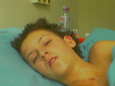 Milica Knežević u bolnici nakon saobraćajnog udesa